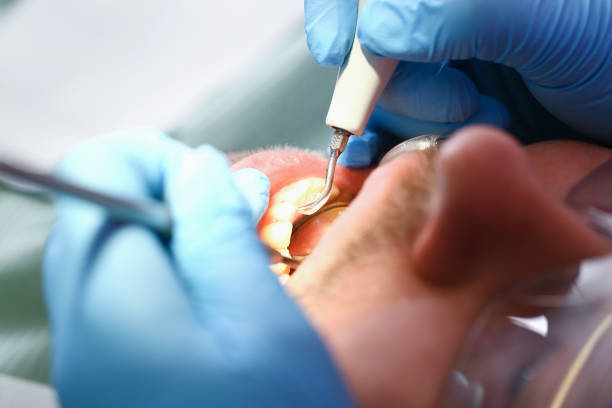 Best Pediatric Emergency Dentist in Iota, LA